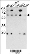 Anti-OXSR1 Rabbit Polyclonal Antibody