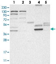 Anti-HPDL Rabbit Polyclonal Antibody