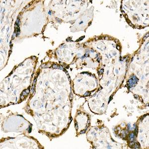 Anti-Fas Ligand Rabbit Polyclonal Antibody