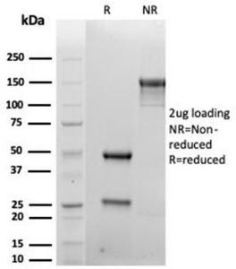 Anti-Syndecan 1 Mouse Recombinant Antibody [clone: rSDC1/6866]