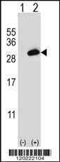 Anti-PSME2 Rabbit Polyclonal Antibody