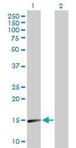 Anti-SNCA Rabbit Polyclonal Antibody