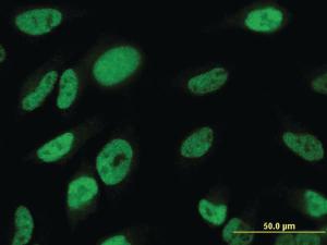 Anti-TBX18 Mouse Monoclonal Antibody [clone: 4D3]