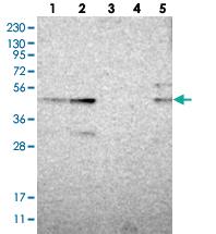 Anti-ZSCAN30 Rabbit Polyclonal Antibody