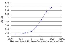 Anti-S100 A8 Mouse Monoclonal Antibody [clone: 1B3]