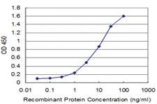 Anti-IRAK4 Mouse Monoclonal Antibody [clone: 1C3]