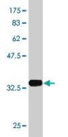 Anti-RPS5 Mouse Monoclonal Antibody [clone: 3G3]