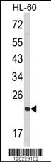 Anti-RAN Rabbit Polyclonal Antibody