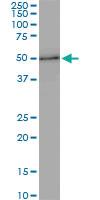 Anti-ZNF622 Mouse Monoclonal Antibody [clone: 4G6]