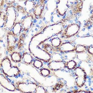 Immunohistochemistry analysis of paraffin-embedded mouse kidney using Anti-FGF2 Antibody (A11129) at a dilution of 1:100 (40X lens). Perform microwave antigen retrieval with 10 mM PBS buffer pH 7.2 before commencing with IHC staining protocol