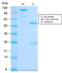 SDS-PAGE analysis of Anti-CD63 Antibody [LAMP3/2990R] under non-reduced and reduced conditions; showing intact IgG and intact heavy and light chains, respectively. SDS-PAGE analysis confirms the integrity and purity of the antibody