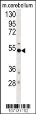 Anti-PXK Rabbit Polyclonal Antibody