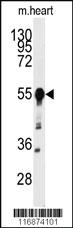 Anti-BACE1 Rabbit Polyclonal Antibody