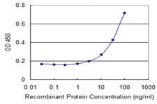 Anti-PARL Mouse Monoclonal Antibody [clone: 4F4]