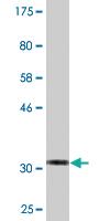 Anti-VAC14 Mouse Monoclonal Antibody [clone: 3B2]