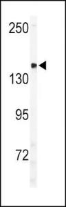 Anti-ULK2 Rabbit Polyclonal Antibody (HRP (Horseradish Peroxidase))