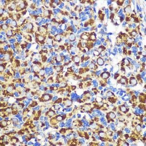 Immunohistochemistry analysis of paraffin-embedded rat ovary using Anti-FGF2 Antibody (A11129) at a dilution of 1:100 (40X lens). Perform microwave antigen retrieval with 10 mM PBS buffer pH 7.2 before commencing with IHC staining protocol