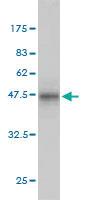 Anti-PPP3R1 Mouse Monoclonal Antibody [clone: 4E1]