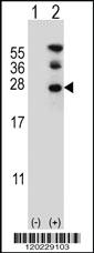 Anti-RAN Rabbit Polyclonal Antibody