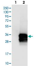 Anti-CALB2 Rabbit Polyclonal Antibody