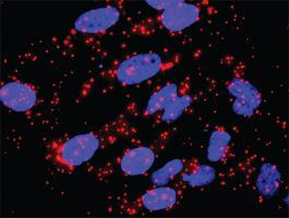 Anti-SKP1 + CACYBP Antibody Pair