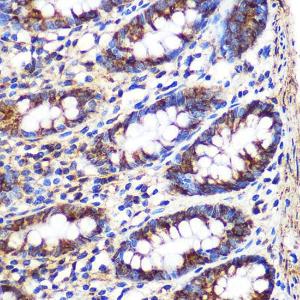 Immunohistochemistry analysis of paraffin-embedded human colon tissue using Anti-FGF2 Antibody (A11129) at a dilution of 1:100 (40X lens). Perform microwave antigen retrieval with 10 mM PBS buffer pH 7.2 before commencing with IHC staining protocol