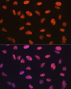 Immunofluorescence analysis of U-2 OS cells using Anti-BAF57/SMARCE1 Antibody [ARC0839] (A308713) at a dilution of 1:100 (40x lens) DAPI was used to stain the cell nuclei (blue)