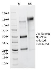 Anti-FSH Receptor antibody