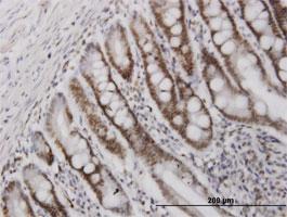 Anti-HMGB2 Mouse Monoclonal Antibody [clone: 3C7]