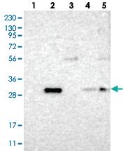 Anti-CALB2 Rabbit Polyclonal Antibody