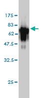 Anti-ACP2 Mouse Monoclonal Antibody [clone: M1-4A12]