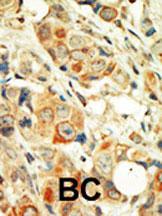 Anti-PRKCA Rabbit Polyclonal Antibody