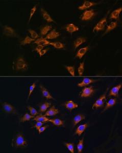 Immunofluorescence analysis of C6 cells using Anti-FGF2 Antibody (A11129) at a dilution of 1:100 (40X lens). DAPI was used to stain the cell nuclei (blue)