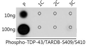 Dot blot analysis of a mixture of peptides using Anti-TDP43 (phospho Ser409 + Ser410) Antibody (A308714) at a 1:1,000 dilution. Exposure time: 1s.