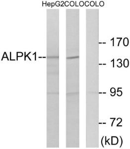 Western blot analysis of lysates from COLO and HepG2 cells using Anti-ALPK1 Antibody. The right hand lane represents a negative control, where the antibody is blocked by the immunising peptide.