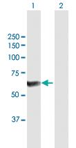 Anti-PPP6C Mouse Polyclonal Antibody