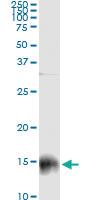 Anti-S100 A9 Mouse Monoclonal Antibody [clone: 1C22]