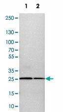 Anti-CALB2 Rabbit Polyclonal Antibody