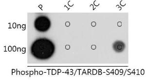 Dot blot analysis of a mixture of peptides using Anti-TDP43 (phospho Ser409 + Ser410) Antibody (A308714) at a 1:1,000 dilution. Exposure time: 10s.