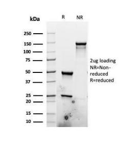 SDS-PAGE analysis of Anti-Ki67 Antibody [rMKI67/6499] under non-reduced and reduced conditions; showing intact IgG and intact heavy and light chains, respectively. SDS-PAGE analysis confirms the integrity and purity of the antibody