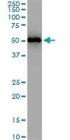 Anti-ZNF622 Mouse Monoclonal Antibody [clone: 4G6]