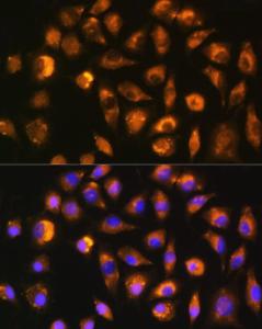 Immunofluorescence analysis of L929 cells using Anti-FGF2 Antibody (A11129) at a dilution of 1:100 (40X lens). DAPI was used to stain the cell nuclei (blue)