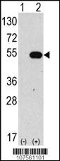 Anti-ATG4C Rabbit Polyclonal Antibody