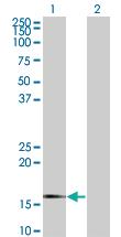 Anti-SNCG Mouse Monoclonal Antibody [clone: 2C3]