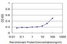 Anti-DLD Mouse monoclonal antibody [clone: 1G11]