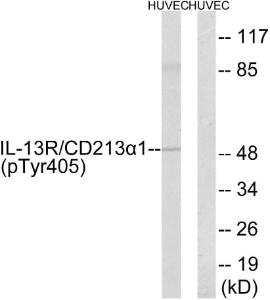 Western blot analysis of lysates from HUVEC cells treated with serum 20% 15' using Anti-IL-13R alpha1 (phospho Tyr405) Antibody. The right hand lane represents a negative control, where the antibody is blocked by the immunising peptide