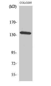 Western blot analysis of various cells using Anti-ALPK1 Antibody