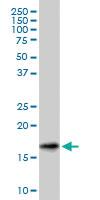 Anti-SNCG Mouse Monoclonal Antibody [clone: 2C3]