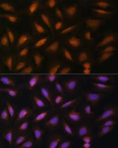 Immunofluorescence analysis of U-2 OS cells using Anti-FGF2 Antibody (A11129) at a dilution of 1:100 (40X lens). DAPI was used to stain the cell nuclei (blue)