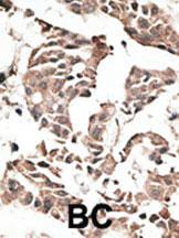 Anti-ATG4C Rabbit Polyclonal Antibody